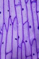 cáscara de cebolla morada bajo el microscopio foto