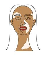 retrato, de, un, mujer, con, vitiligo, línea, arte, vector, ilustración