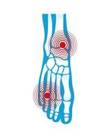 foot rheumatological pain vector