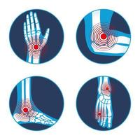 four rheumatology icons vector