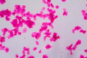 Epitelio escamoso múltiple bajo el microscopio - puntos abstractos de color rosa sobre fondo blanco. foto
