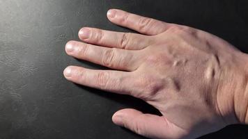 Hand of a man in various states on a black background photo