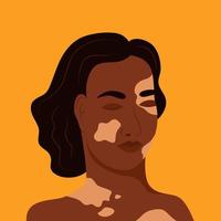 A young woman with vitiligo isolated on a yellow background. Flat vector illustration