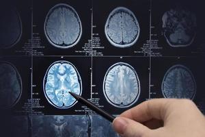 Brain research, magnetic resonance imaging photo