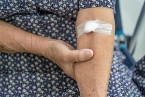 Asian senior or elderly old lady woman patient show cotton wool stop bleeding, after blood drawing testing for annually physical health check up to check cholesterol, blood pressure, and sugar level.