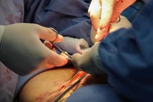 Medical team of surgeons operating in a plastic surgery clinic. photo