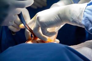 Open breast surgery, placing a prosthesis. Close-up of the breast and the hands and tools of the doctors. photo