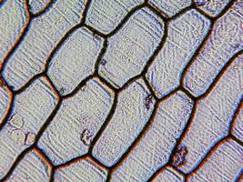 micrografía de epidermus de cebolla