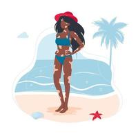 Vitiligo skin disease in African American girl in a swimsuit. woman with a diagnosis of vitiligo sunbathing on the beach is not shy. the concept of different beauty, bodily positive, self-acceptance. vector