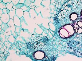 micrografía de tallo de cucurbita foto