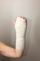 Lady with a Broken Hand and Wrist wrapped in a cast photo