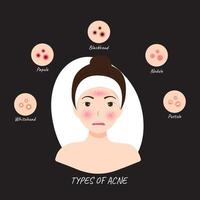 ilustraciones de tipos de acné ocurren en la cara de una mujer
