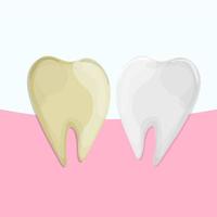 Professional Teeth Whitening, Healthy and yellow Tooth, vector illustration