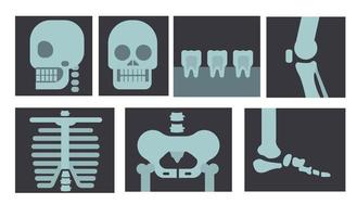 Xray of human body, teeth and bone in flat design illustration vector