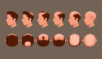 Cabeza de hombre con problema de pérdida de cabello en el vector de ilustración de conjunto de símbolos de vista lateral y superior