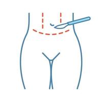 Tummy tuck plastic color icon. Abdominoplasty. Stomach liposuction. Abdominal lifting. Plastic surgery. Isolated vector illustration