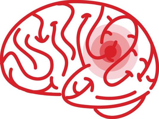 The brain has a red signal on white background