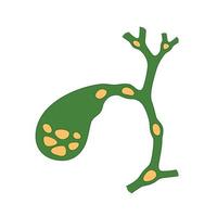 Variants of the location of stones in the gallbladder and bile ducts. Schematic drawing for cholelithiasis, gallstone disease. vector