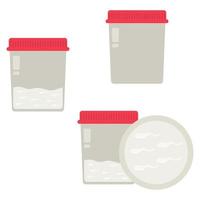 examen de semen, recipientes de recolección y recuento de espermatozoides, líquido seminal en un recipiente para examen o donación vector