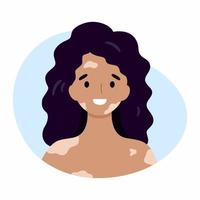 A happy woman with vitiligo. The girl suffers from problems with the skin of the face and body. vector