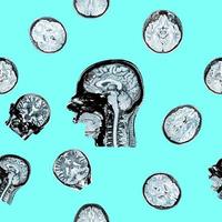 MRI of the head on a blue background. Seamless pattern. The concept of timely detection of diseases of the head. Mental health. photo