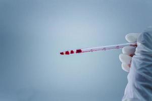 Medical laboratory. Pipette with blood in the hand in a medical glove on a blue background. The concept of laboratory research. photo