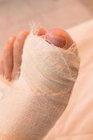 Close up of a Persons Bandaged up Broken Big Toe photo