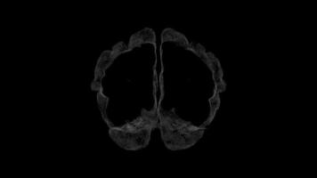 Brain Scan MRI Brain Imaging Diagnostic video