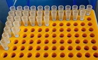 Tips in orange plastic rack for micropipette photo