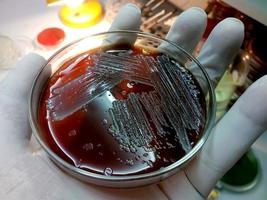 colonias de bacterias en agar chocolate. placa de medio de cultivo. placa de Petri foto