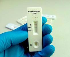 Close view of technician or technologist hand hold a device of herpes simplex virus rapid screening test, showing positive result. photo