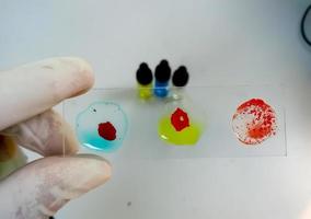 Blood group testing by slide agglutination method photo