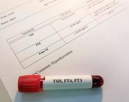 Blood sample with abnormal report of thyroid hormone isolated. Hyperthyroidism occurs when your thyroid gland produces too much of the hormone. photo
