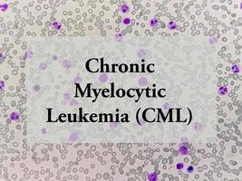Chronic myelocytic leukemia term. Health and medical concept. CML photo
