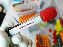 Blood sample for LDH - Isoenzyme test. actate dehydrogenase, diagnosis for cellular destruction or tissue damage.