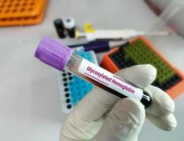 muestra de sangre para prueba de hemoglobina glicosilada con antecedentes de laboratorio. hba1c. hemoglobina a1c foto