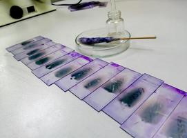 Stained glass slides of peripheral blood smear with violet leishman giemsa stain is isolated in hematology department which is ready for microscopic examination. photo