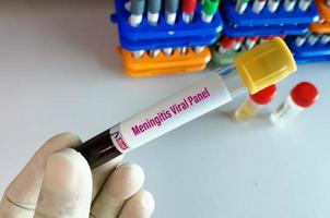 muestra de sangre para la prueba de panel viral de meningitis con antecedentes de laboratorio. foto