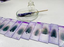 Portaobjetos de vidrieras hematológicas e informe aislado en mesa con microscopio en laboratorio. foto