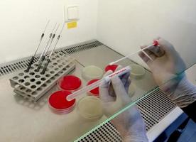 El microbiólogo sostiene el hisopo vaginal para la prueba de cultivo en el laboratorio de microbilogía. uti foto