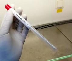 Medical worker holding  NP OP swab sample for COVID-19  Omicron variant test, B.1.1.529, RT-PCR DNA molecular nucleic acid diagnostic. photo