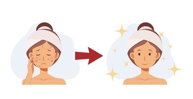 treat acne,skin problem,pimple .woman face.Beautyful. Flat vector 2d cartoon character illustration. Before, after