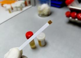 Hand holding Glucose strip showing abnormal result with laboratory background. urine sugar test. urinalysis. photo