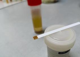 Testing strip and sample container isolated for urine glucose test, showing abnormal result. urine sugar test. urinalysis. photo