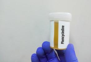 Contenedor de orina de laboratorio médico con muestra de orina para la prueba de drogas fenciclidina. diagnóstico de fenciclidina droga ilegal en orina. foto