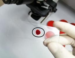 La mano del científico sostiene un portaobjetos de vidrio con una gota de sangre para realizar más pruebas de laboratorio. foto