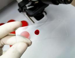 Hand of scientist hold glass slide with a drop of blood for further laboratorical testing. photo