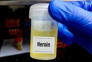 Urine sample for Heroine drug test. Drug test is technical analysis of specimen to determine illegal drug abuse as heroin level. photo