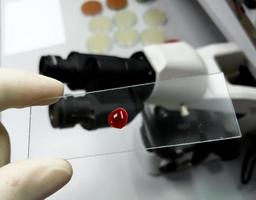 Hand of scientist hold glass slide with a drop of blood for further laboratorical testing. photo