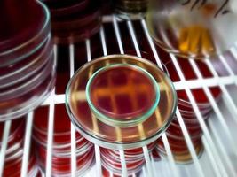 placa de Petri con medio de agar sangre aislado en incubadora, placa de medio de cultivo foto